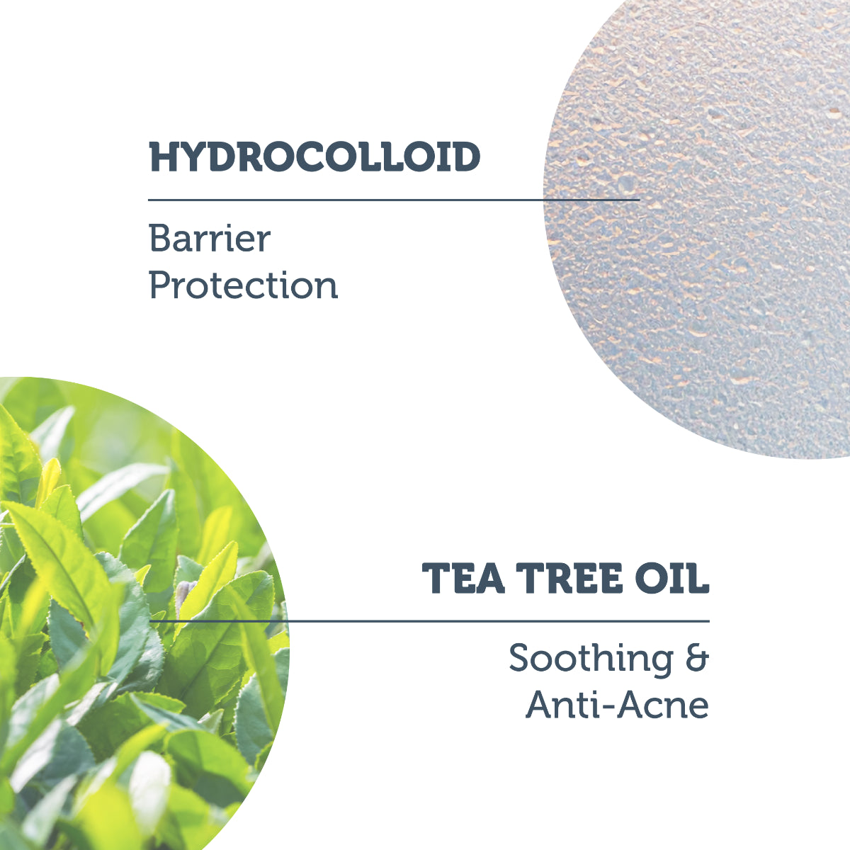 Hydrocolloid Anti-Acne & Soothing Patches, Pack of 36
