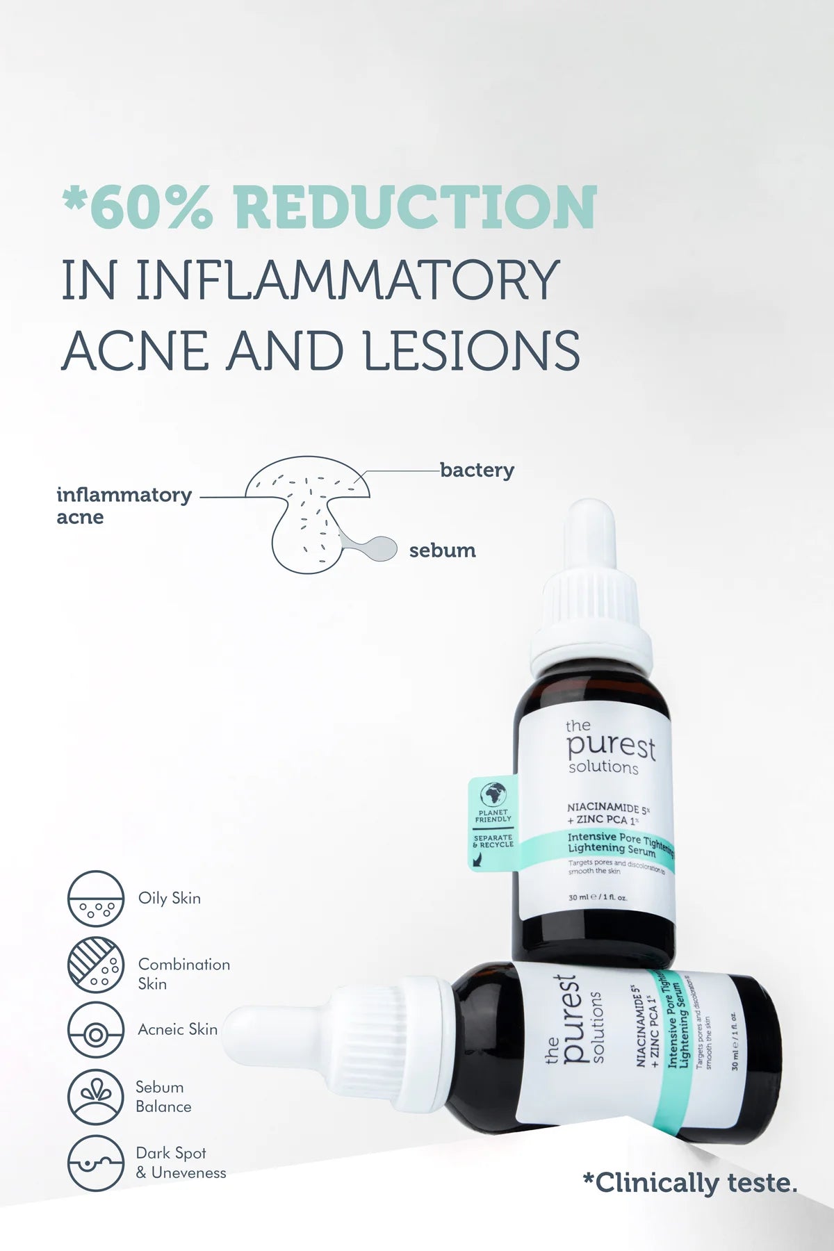 Anti-Pore, Acne and Blackhead Niacinamide Serum 30 Ml