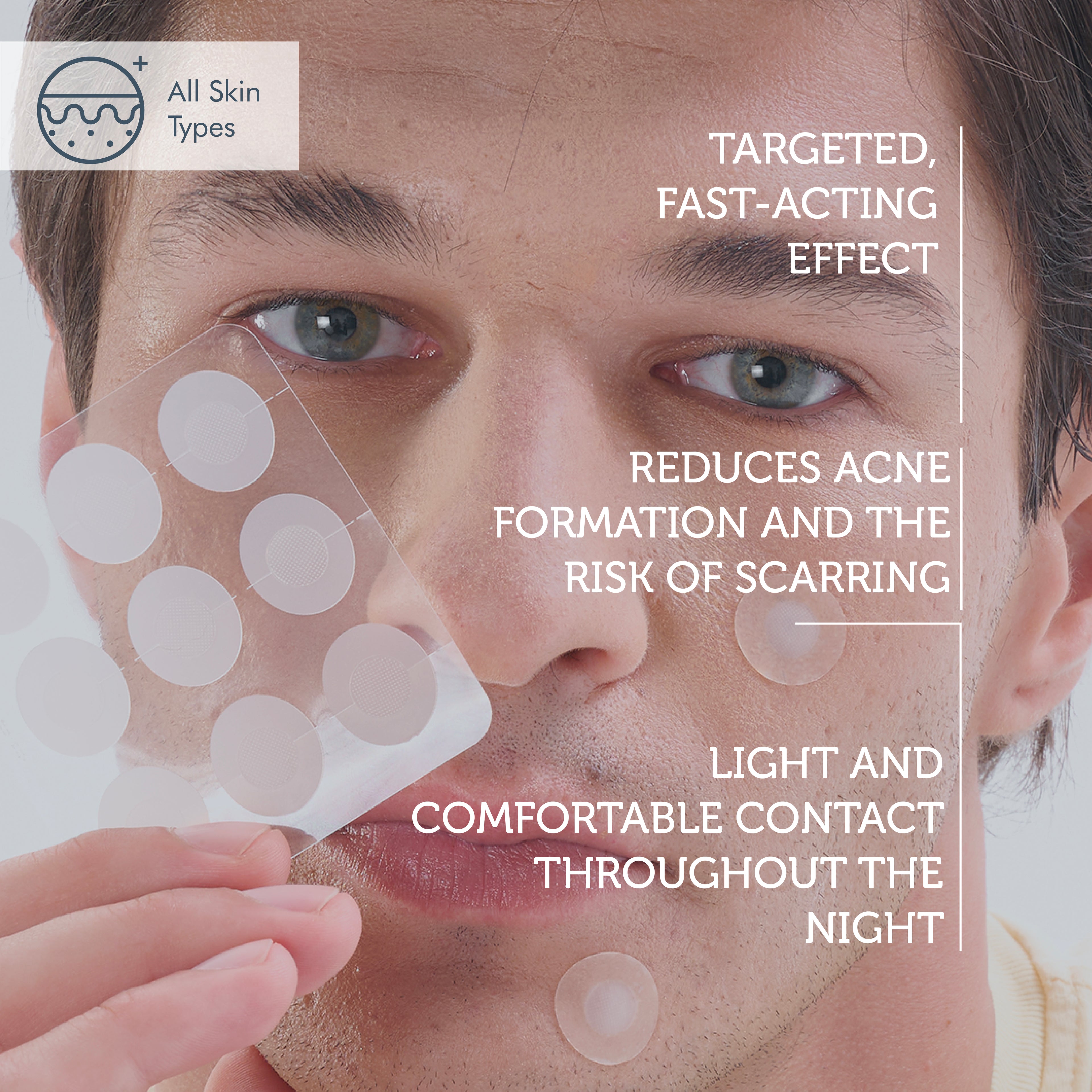 Microneedle Technology Acne Patch, Anti-Acne Patch, Microneedle Acne Strip, 9 Pieces