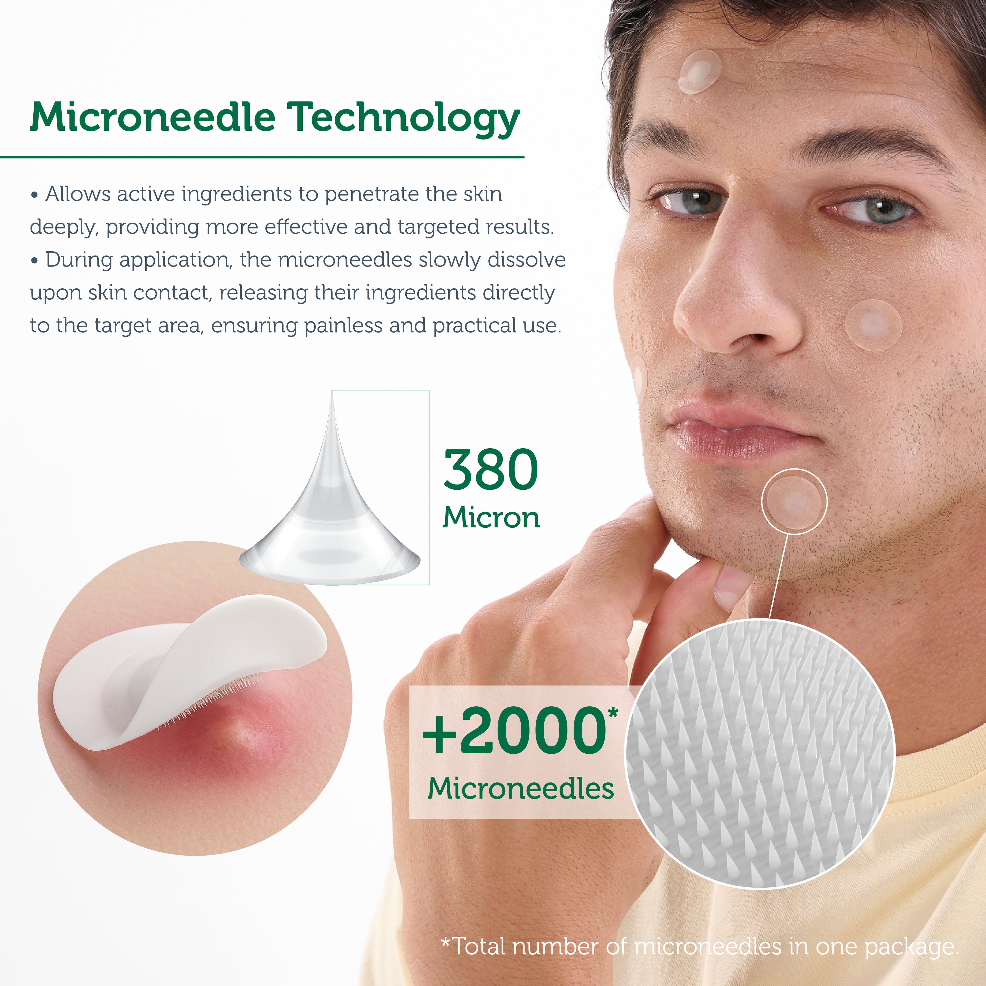 Microneedle Technology Acne Patch, Anti-Acne Patch, Microneedle Acne Strip, 9 Pieces