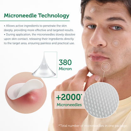 Microneedle Technology Acne Patch, Anti-Acne Patch, Microneedle Acne Strip, 9 Pieces